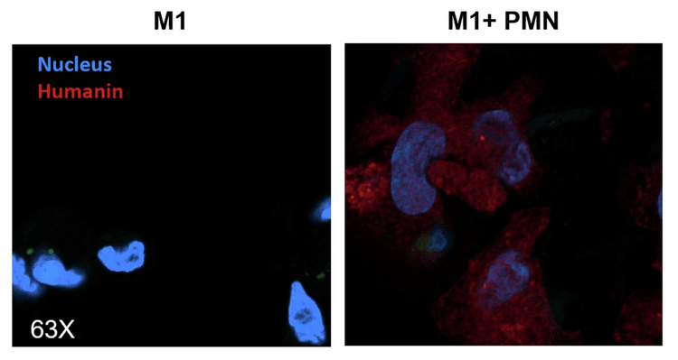 Maraux et al 2025 Cell Death   Disease